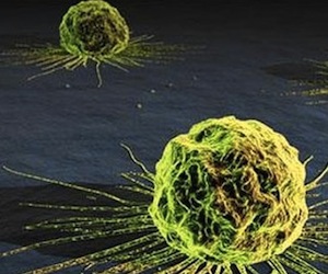 Científicos descubren gen responsable de cáncer de pulmón